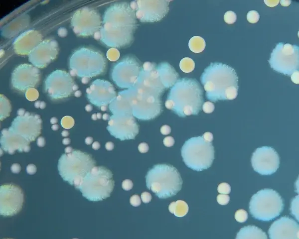 Bacterial cultures growing on an agar plate in a microbiology lab