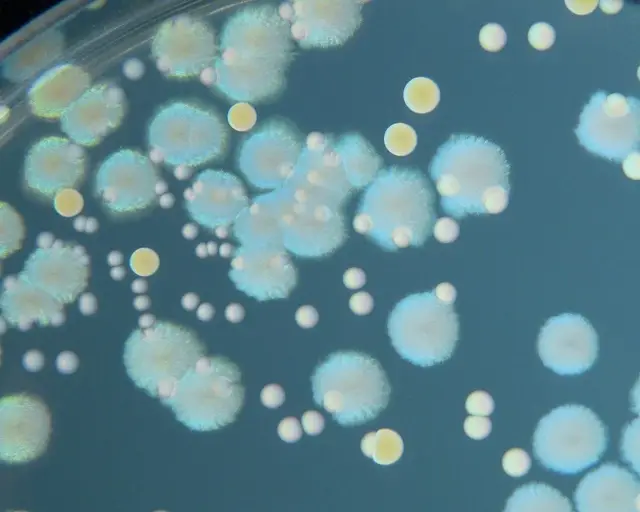 Bacterial cultures growing on an agar plate in a microbiology lab